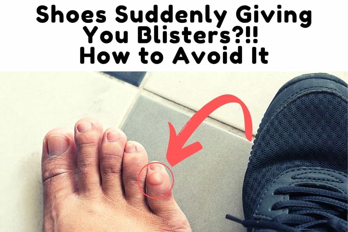 Why Are Your Shoes Suddenly Giving You Blisters? Prevention Methods ...